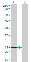 Anti-PCTP Mouse Monoclonal Antibody [clone: 1F9]