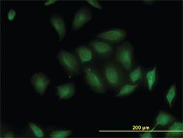 Anti-STK26 Mouse Monoclonal Antibody [clone: 2G6]