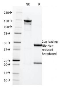 SDS-PAGE analysis of Anti-HCG beta Antibody [HCGb/1996R] under non-reduced and reduced conditions; showing intact IgG and intact heavy and light chains, respectively. SDS-PAGE analysis confirms the integrity and purity of the antibody.