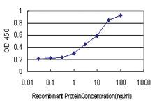 Anti-STK26 Mouse Monoclonal Antibody [clone: 2G6]