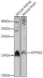 Western blot analysis of extracts of various cell lines, using Anti-ATP synthase C Antibody (A305450) at 1:1,000 dilution The secondary antibody was Goat Anti-Rabbit IgG H&L Antibody (HRP) at 1:10,000 dilution Lysates/proteins were present at 25 µg per lane