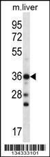 Anti-CBX8 Rabbit Polyclonal Antibody (AP (Alkaline Phosphatase))