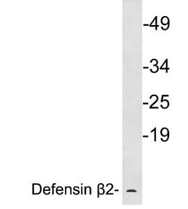 Western blot analysis of lysates from human skin using Anti-Defensin beta2 Antibody