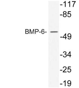 Western blot analysis of lysate from 293 cells treated with TNF using Anti-BMP-6 Antibody