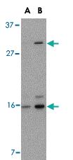 Anti-DRAM Rabbit Polyclonal Antibody