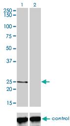 Anti-PCTP Mouse Monoclonal Antibody [clone: 1F9]