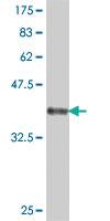 Anti-PTH1R Mouse Polyclonal Antibody