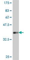 Anti-ST3GAL5 Mouse Polyclonal Antibody