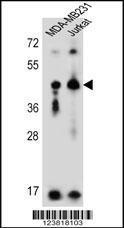 Anti-KIR2DL2 Rabbit Polyclonal Antibody