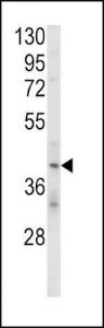 Anti-KIR2DL4 Rabbit Polyclonal Antibody (AP (Alkaline Phosphatase))