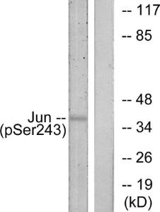 Western blot analysis of lysates from HeLa cells treated with UV using Anti-c-Jun (phospho Ser243) Antibody. The right hand lane represents a negative control, where the Antibody is blocked by the immunising peptide