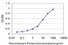 Anti-ARAF Mouse Monoclonal Antibody [clone: 5H8]