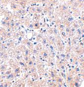 Anti-DRAM Rabbit Polyclonal Antibody