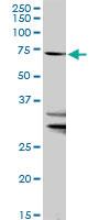 Anti-SLC27A1 Rabbit Polyclonal Antibody