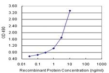 Anti-RCVRN Polyclonal Antibody Pair