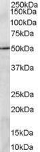 Anti-PRDM11 Antibody (A83888) (2 µg/ml) staining of A549 lysate (35 µg protein in RIPA buffer) Primary incubation was 1 hour Detected by chemiluminescence