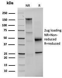 SDS-PAGE analysis of Anti-Prolactin Antibody [PRL/2642] under non-reduced and reduced conditions; showing intact IgG and intact heavy and light chains, respectively SDS-PAGE analysis confirms the integrity and purity of the antibody