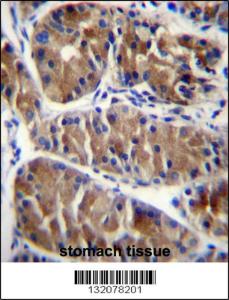 Anti-ENOX2 Rabbit Polyclonal Antibody (HRP (Horseradish Peroxidase))