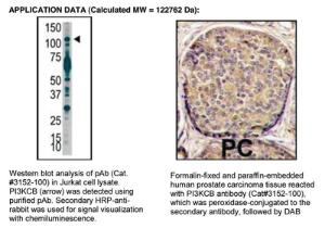 Anti-Phosphoinositide 3 Kinase, p110 beta Rabbit Polyclonal Antibody