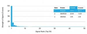 Analysis of protein array containing more than 19,000 full-length human proteins using Anti-Prolactin Antibody [PRL/2642] Z-Score and S- Score