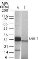 Anti-Sars Envelope Protein Rabbit Polyclonal Antibody