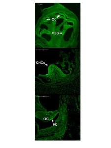 Anti-ATOH1 Rabbit Polyclonal Antibody