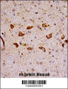 Anti-PAK7 Rabbit Polyclonal Antibody (APC (Allophycocyanin))