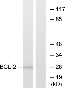 Western blot analysis of lysates from MCF7 cells, treated with Etoposide using Anti-BCL-2 Antibody. The right hand lane represents a negative control, where the antibody is blocked by the immunising peptide