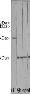 Antibody anti-HSP27 6H11 100 µl