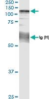 Anti-CC2D1A Rabbit Polyclonal Antibody