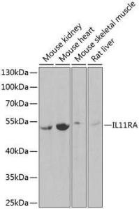 Anti-IL-11RA antibody