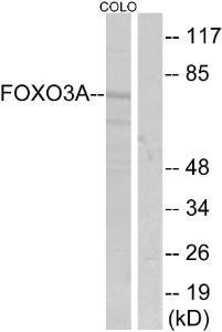 Western blot analysis of lysates from COLO205 cells, treated with serum using Anti-FKHRL1 Antibody. The right hand lane represents a negative control, where the antibody is blocked by the immunising peptide