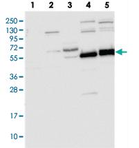 Anti-TRIM7 Rabbit Polyclonal Antibody