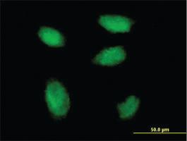 Anti-RSF1 Mouse Monoclonal Antibody [clone: 3E6]