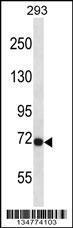 Anti-FGFR3 Rabbit Polyclonal Antibody (APC (Allophycocyanin))