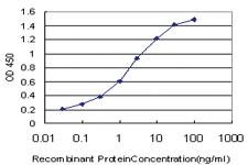 Anti-RSF1 Mouse Monoclonal Antibody [clone: 3E6]