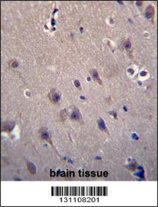 Anti-MCF2 Rabbit Polyclonal Antibody