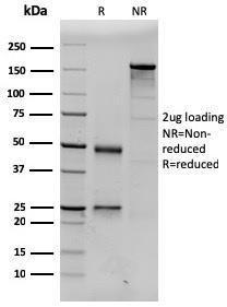 SDS-PAGE analysis of Anti-Prolactin Antibody [PRL/2643] under non-reduced and reduced conditions; showing intact IgG and intact heavy and light chains, respectively. SDS-PAGE analysis confirms the integrity and purity of the antibody