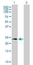 Anti-PAEP Rabbit Polyclonal Antibody