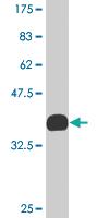 Anti-KLF2 Mouse Monoclonal Antibody [clone: 1D1]