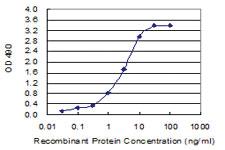 Anti-RCVRN Polyclonal Antibody Pair