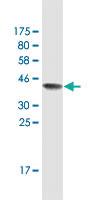 Anti-BUB1B Mouse Monoclonal Antibody [clone: 2G9]