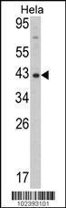 Anti-DNMT3L Rabbit Polyclonal Antibody (HRP (Horseradish Peroxidase))