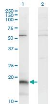 Anti-PAEP Mouse Monoclonal Antibody [clone: 6G2]