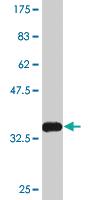 Anti-KLF2 Mouse Monoclonal Antibody [clone: 1D12]