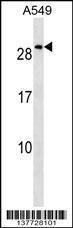 Anti-NKX2-8 Rabbit Polyclonal Antibody