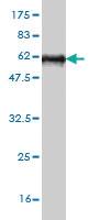 Anti-STC2 Mouse Monoclonal Antibody [clone: 2B11]