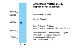 Anti-ATOH1 Rabbit Polyclonal Antibody