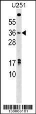 Anti-NKX3-1 Rabbit Polyclonal Antibody (AP (Alkaline Phosphatase))