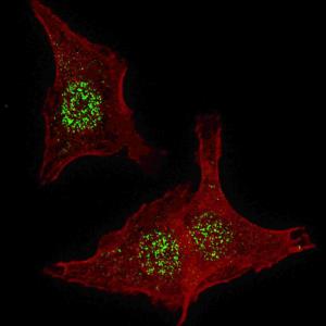 Anti-FGFR4 Rabbit Polyclonal Antibody (AP (Alkaline Phosphatase))